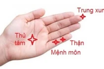 Kích thích huyệt phục hồi tóc rụng sau sốt xuất huyết