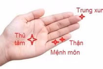 Kích thích huyệt phục hồi tóc rụng sau sốt xuất huyết