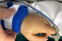 Viêm não mô cầu dễ gây tử vong nhanh, cần biết cách phòng ngừa