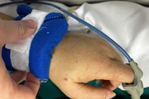 Viêm não mô cầu dễ gây tử vong nhanh, cần biết cách phòng ngừa