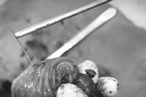 Chàng trai 33 tuổi bị xương cá đâm thủng ruột non, gây áp xe ổ bụng