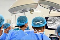 Tạo van bán vòng điều trị bệnh co thắt tâm vị gây biến chứng nghiêm trọng