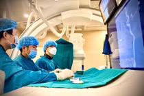 Bệnh viện Bạch Mai lập kỷ lục can thiệp đột quỵ trong 6 phút