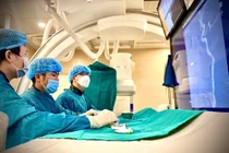 Bệnh viện Bạch Mai lập kỷ lục can thiệp đột quỵ trong 6 phút