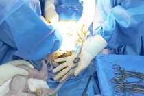 Cứu thai nhi 38 tuần bị dây rốn thắt nút, quấn cổ 2 vòng