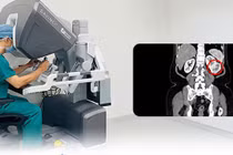 Đang khỏe mạnh bỗng phát hiện ung thư thận