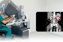 Đang khỏe mạnh bỗng phát hiện ung thư thận