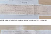 Cứu thành công bệnh nhân cơn nhịp nhanh kịch phát trên thất