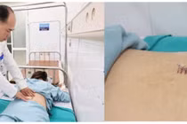 Thoát vị đĩa đệm đốt sống thắt lưng, bệnh lý hiếm gặp ở trẻ