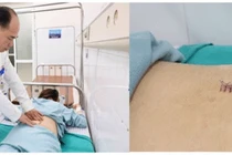 Thoát vị đĩa đệm đốt sống thắt lưng, bệnh lý hiếm gặp ở trẻ