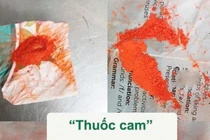 Bôi thuốc cam chữa sẩn ngứa bé 5 tuổi ngộ độc chì