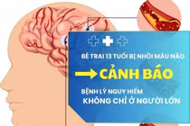 13 tuổi nhồi máu não, bệnh nguy hiểm không chỉ ở người lớn
