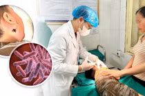 Bùn nước sau lũ lụt cẩn thận vi khuẩn ăn thịt người tấn công gây tử vong