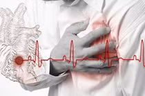 Các bệnh gây triệu chứng hồi hộp đánh trống ngực