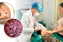 Bùn nước sau lũ lụt cẩn thận vi khuẩn ăn thịt người tấn công gây tử vong