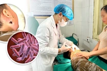 Đau mang tai, sốt cao trẻ 4 tuổi nguy kịch vì vi khuẩn ăn thịt người