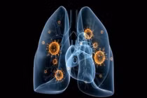 Chủ động bảo vệ sức khỏe hô hấp từ những thói quen nhỏ