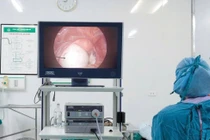 Lấy u quái chứa da, xương, tóc cho bệnh nhân 21 tuổi