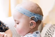 Nghe kém ở trẻ, nhận thức sớm tránh mất cơ hội vàng điều trị