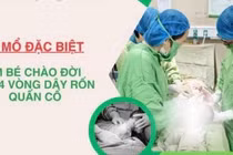 Ca mổ đặc biệt cứu thai nhi bị dây rốn quấn cổ 4 vòng