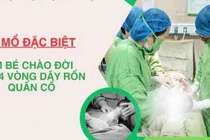 Ca mổ đặc biệt cứu thai nhi bị dây rốn quấn cổ 4 vòng