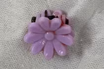 Xử trí dị vật bất thường đường âm đạo cho bé gái 8 tuổi 