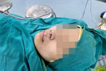 Mổ lần 3 tìm lại nụ cười cho hai chị em bị dị tật khe hở môi mũi bẩm sinh