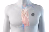 Chàng trai ở TP HCM mắc hội chứng Kearns–Sayre hiếm gặp