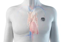 Chàng trai ở TP HCM mắc hội chứng Kearns–Sayre hiếm gặp