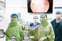 Phẫu thuật cho sản phụ dị tật hệ sinh sản, tiết niệu