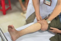 Đau tức, tê buốt hai chân, người đàn ông bị tắc nghẽn động mạch đùi