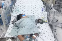Bệnh nhi 4,5 tháng tuổi bị sốc sốt xuất huyết