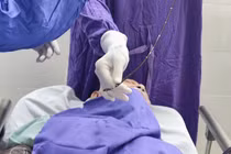 Hạt hồng xiêm gây đông đặc nhu mô phổi cụ bà 90 tuổi