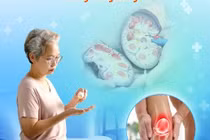 Cẩn thận thuốc xương khớp gia truyền gây suy tuyến thượng thận, trụy tim mạch