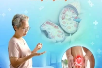 Cẩn thận thuốc xương khớp gia truyền gây suy tuyến thượng thận, trụy tim mạch