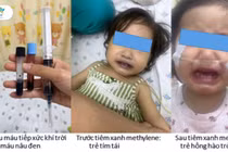 Ăn ghẹ, canh cải nấu với nước giếng, bé gái máu chuyển đen