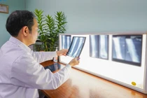 Tái tạo thành công mắt cá ngoài, khớp cổ chân cho bé 8 tuổi mắc ung thư sụn