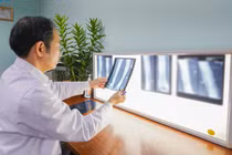 Tái tạo thành công mắt cá ngoài, khớp cổ chân cho bé 8 tuổi mắc ung thư sụn