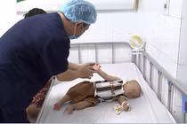 3000 trẻ khám tay chân miệng, bác sĩ chỉ rõ dấu hiệu trở nặng cần cấp cứu