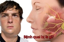 Nam bệnh nhân 41 tuổi bị biến chứng nặng do quai bị