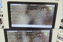 Lọc máu cứu sống cụ bà 88 tuổi rối loạn nhịp tim do tăng Kali máu