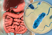 Bộ Y tế hướng dẫn người dân biện pháp phòng chống dịch bệnh tả