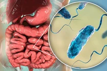 Bộ Y tế hướng dẫn người dân biện pháp phòng chống dịch bệnh tả