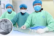 Cứu 2 người ngừng tim, suy hô hấp do biến chứng nhồi máu cơ tim