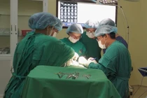 Đau mặt 1 bên không ngờ u tuyến mang tai chèn ép dây thần kinh mặt