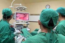 Đau bụng, ăn kém không ngờ ung thư đại trực tràng