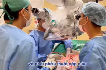 Đang khỏe mạnh bỗng đau đầu, hôn mê vì vỡ túi phình động mạch não