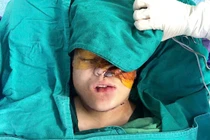 Hành trình nhân đạo loại bỏ khối u "khổng lồ" tái tạo mặt cho bé gái 16 tuổi