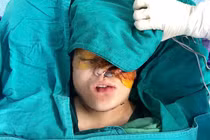 Hành trình nhân đạo loại bỏ khối u "khổng lồ" tái tạo mặt cho bé gái 16 tuổi