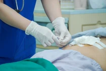 Khó thở, lồng ngực bị bóp nghẹt cần thận tràn dịch màng tim nguy kịch